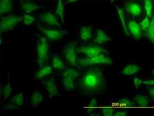 DOCK4 Antibody - Immunofluorescence of monoclonal antibody to DOCK4 on HeLa cell (antibody concentration 10 ug/ml).