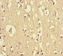 DOCK6 Antibody - Immunohistochemistry of paraffin-embedded human brain tissue at dilution of 1:100