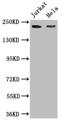 DOCK7 Antibody - Positive WB detected in:Jurkat whole cell lysate,Hela whole cell lysate;All lanes: DOCK7 antibody at 3ug/ml;Secondary;Goat polyclonal to rabbit IgG at 1/50000 dilution;Predicted band size: 243,242,239,73,240 kDa;Observed band size: 243 kDa;