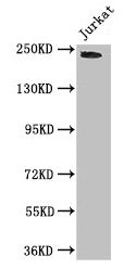 DOCK7 Antibody - Western Blot Positive WB detected in: Jurkat whole cell lysate All lanes: DOCK7 antibody at 3µg/ml Secondary Goat polyclonal to rabbit IgG at 1/50000 dilution Predicted band size: 243, 242, 239, 240, 73 kDa Observed band size: 243 kDa