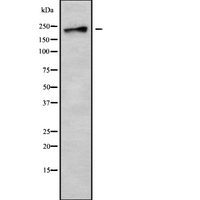 DOCK7 Antibody - Western blot analysis of DOCK7 using HT29 whole cells lysates