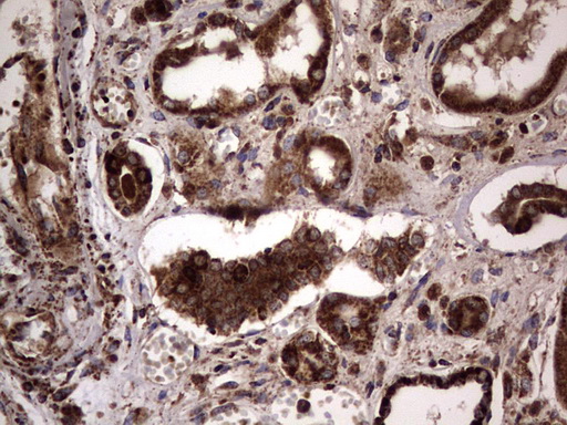DOCK8 Antibody - IHC of paraffin-embedded Human Kidney tissue using anti-DOCK8 mouse monoclonal antibody. (Heat-induced epitope retrieval by 1 mM EDTA in 10mM Tris, pH8.5, 120°C for 3min).