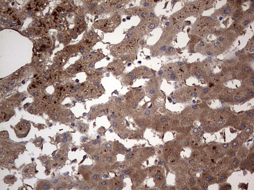 DOCK8 Antibody - IHC of paraffin-embedded Human liver tissue using anti-DOCK8 mouse monoclonal antibody. (Heat-induced epitope retrieval by 1 mM EDTA in 10mM Tris, pH8.5, 120°C for 3min).