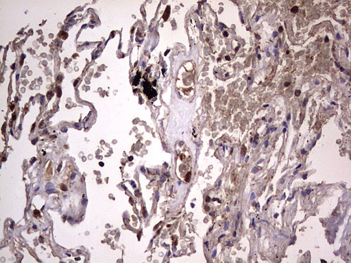 DOCK8 Antibody - IHC of paraffin-embedded Human lung tissue using anti-DOCK8 mouse monoclonal antibody. (Heat-induced epitope retrieval by 1 mM EDTA in 10mM Tris, pH8.5, 120°C for 3min).