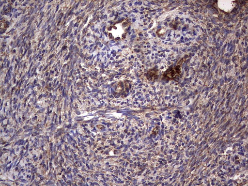 DOCK8 Antibody - IHC of paraffin-embedded Human Ovary tissue using anti-DOCK8 mouse monoclonal antibody. (Heat-induced epitope retrieval by 1 mM EDTA in 10mM Tris, pH8.5, 120°C for 3min).