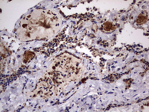 DOCK8 Antibody - IHC of paraffin-embedded Human thyroid tissue using anti-DOCK8 mouse monoclonal antibody. (Heat-induced epitope retrieval by 1 mM EDTA in 10mM Tris, pH8.5, 120°C for 3min).
