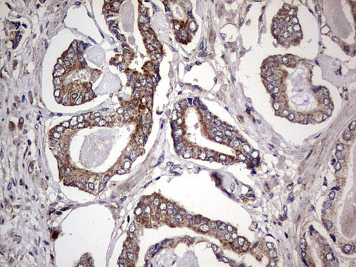 DOCK8 Antibody - IHC of paraffin-embedded Human prostate tissue using anti-DOCK8 mouse monoclonal antibody. (Heat-induced epitope retrieval by 1 mM EDTA in 10mM Tris, pH8.5, 120°C for 3min).