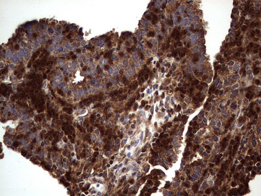 DOCK8 Antibody - IHC of paraffin-embedded Human lymph node tissue using anti-DOCK8 mouse monoclonal antibody. (Heat-induced epitope retrieval by 1 mM EDTA in 10mM Tris, pH8.5, 120°C for 3min).