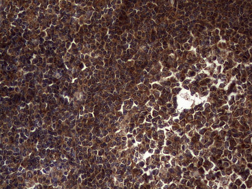 DOCK8 Antibody - IHC of paraffin-embedded Human tonsil using anti-DOCK8 mouse monoclonal antibody. (Heat-induced epitope retrieval by 1 mM EDTA in 10mM Tris, pH8.5, 120°C for 3min).