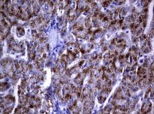 DOCK8 Antibody - IHC of paraffin-embedded Human liver tissue using anti-DOCK8 mouse monoclonal antibody. (Heat-induced epitope retrieval by 1 mM EDTA in 10mM Tris, pH9.0, 120°C for 3min).