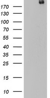 DOCK8 Antibody - HEK293T cells were transfected with the pCMV6-ENTRY control (Left lane) or pCMV6-ENTRY DOCK8 (Right lane) cDNA for 48 hrs and lysed. Equivalent amounts of cell lysates (5 ug per lane) were separated by SDS-PAGE and immunoblotted with anti-DOCK8.