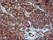 DOCK8 Antibody - IHC of paraffin-embedded Human pancreas tissue using anti-DOCK8 mouse monoclonal antibody. (Heat-induced epitope retrieval by 10mM citric buffer, pH6.0, 120°C for 3min).