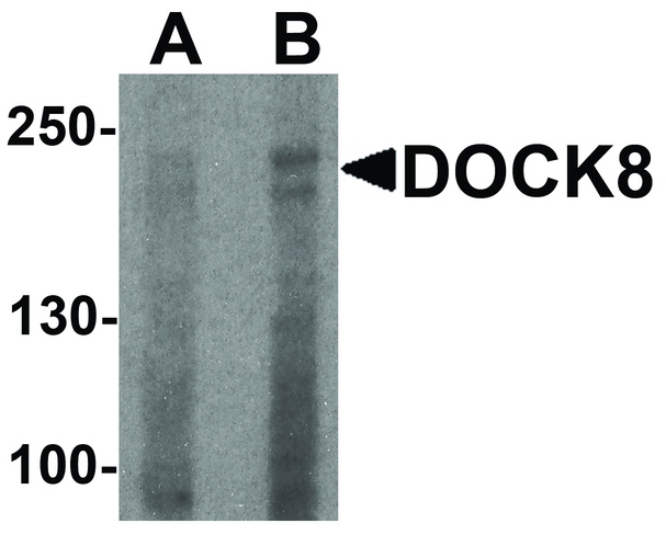 DOCK8 Antibody - Western blot analysis of DOCK8 in EL4 cell lysate with DOCK8 antibody at (A) 1 and (B) 2 ug/ml.