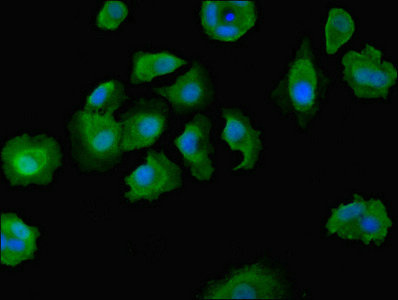 DOCK8 Antibody - Immunofluorescent analysis of MCF-7 cells diluted at 1:100 and Alexa Fluor 488-congugated AffiniPure Goat Anti-Rabbit IgG(H+L)
