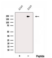 DOCK8 Antibody - Western blot analysis of extracts of A549 cells using DOCK8 antibody. The lane on the left was treated with blocking peptide.