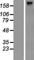 DOCK8 Protein - Western validation with an anti-DDK antibody * L: Control HEK293 lysate R: Over-expression lysate