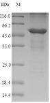 ANXA4 / Annexin IV Protein - (Tris-Glycine gel) Discontinuous SDS-PAGE (reduced) with 5% enrichment gel and 15% separation gel.