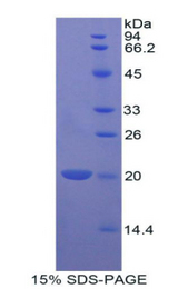 BCL2L2 / Bcl-w Protein - Recombinant B-Cell CLL/Lymphoma 2 Like Protein 2 By SDS-PAGE