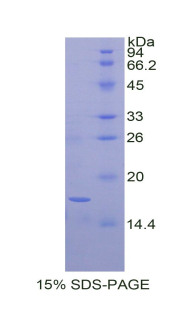 BDNF Protein - Recombinant Brain Derived Neurotrophic Factor By SDS-PAGE