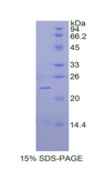 BMP2 Protein - Recombinant Bone Morphogenetic Protein 2 By SDS-PAGE