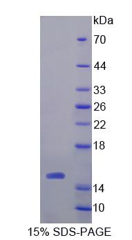 Calcitonin Protein - Recombinant  Calcitonin By SDS-PAGE