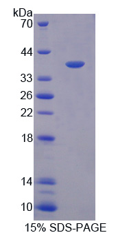 CCL19 / MIP3-Beta Protein - Recombinant Macrophage Inflammatory Protein 3 Beta By SDS-PAGE