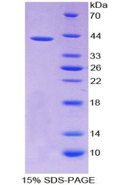 CCL2 / MCP1 Protein - Recombinant  Monocyte Chemotactic Protein 1 By SDS-PAGE