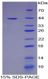 CCL22 / MDC Protein - Recombinant Macrophage Derived Chemokine By SDS-PAGE