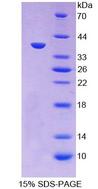 CCL3 / MIP-1-Alpha Protein - Recombinant  Macrophage Inflammatory Protein 1 Alpha By SDS-PAGE