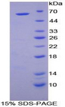 CTSA / Cathepsin A Protein - Recombinant Cathepsin A By SDS-PAGE