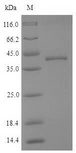 CTSK / Cathepsin K Protein - (Tris-Glycine gel) Discontinuous SDS-PAGE (reduced) with 5% enrichment gel and 15% separation gel.