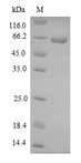 DMP1 Protein - (Tris-Glycine gel) Discontinuous SDS-PAGE (reduced) with 5% enrichment gel and 15% separation gel.