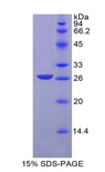 EGF Protein - Recombinant Epidermal Growth Factor By SDS-PAGE