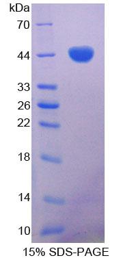 Gastrin Protein - Recombinant  Gastrin By SDS-PAGE
