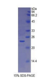 HLA-DRA Protein - Recombinant Major Histocompatibility Complex Class II DR Alpha By SDS-PAGE