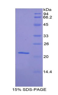HP / Haptoglobin Protein - Recombinant Haptoglobin By SDS-PAGE