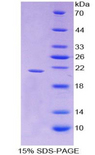 IFN Gamma / Interferon Gamma Protein - Recombinant  Interferon Gamma By SDS-PAGE