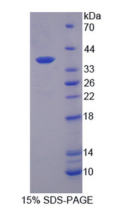 IL12B / IL12 p40 Protein - Recombinant Interleukin 12B By SDS-PAGE