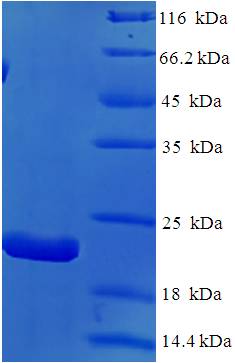IL18 Protein