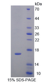 IL4 Protein - Recombinant  Interleukin 4 By SDS-PAGE
