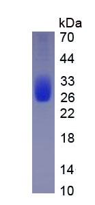 IL6 / Interleukin 6 Protein - Eukaryotic Interleukin 6 (IL6) by SDS-PAGE