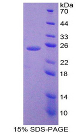 IL6 / Interleukin 6 Protein - Recombinant Interleukin 6 By SDS-PAGE