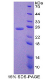 IL6 / Interleukin 6 Protein - Recombinant Interleukin 6 By SDS-PAGE