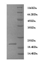 IL8 / Interleukin 8 Protein - (Tris-Glycine gel) Discontinuous SDS-PAGE (reduced) with 5% enrichment gel and 15% separation gel.