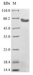 LHB / Luteinizing Hormone Protein - (Tris-Glycine gel) Discontinuous SDS-PAGE (reduced) with 5% enrichment gel and 15% separation gel.