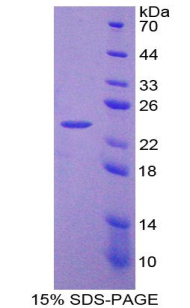 LIF Protein - Recombinant Leukemia Inhibitory Factor By SDS-PAGE