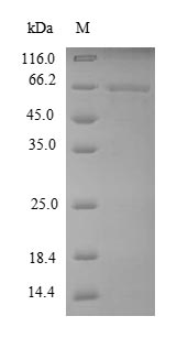 MMP13 Protein - (Tris-Glycine gel) Discontinuous SDS-PAGE (reduced) with 5% enrichment gel and 15% separation gel.