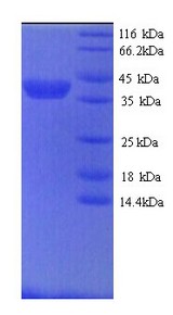 MMP9 / Gelatinase B Protein