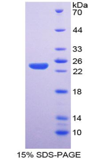 NOS3 / eNOS Protein - Recombinant  Nitric Oxide Synthase 3, Endothelial By SDS-PAGE