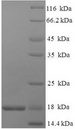 NPC2 Protein - (Tris-Glycine gel) Discontinuous SDS-PAGE (reduced) with 5% enrichment gel and 15% separation gel.